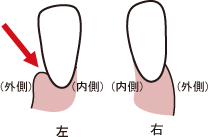 歯茎の図